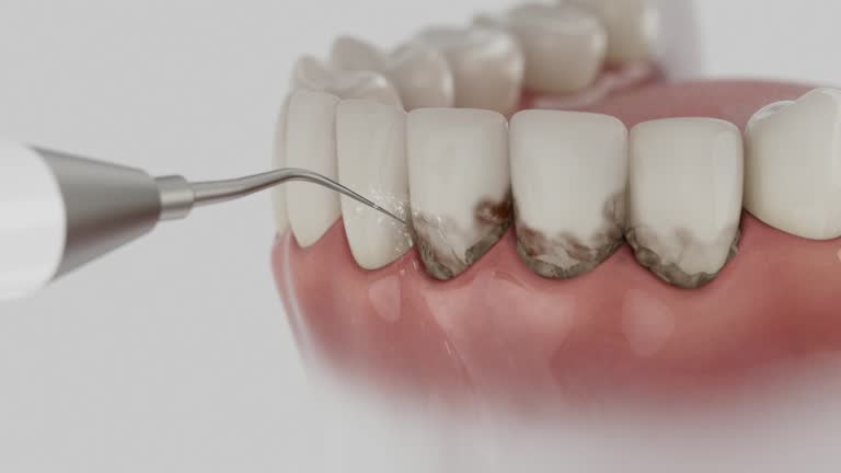 Trusted Dental Implants service in Patton Village, TX - Dentist Open Now
